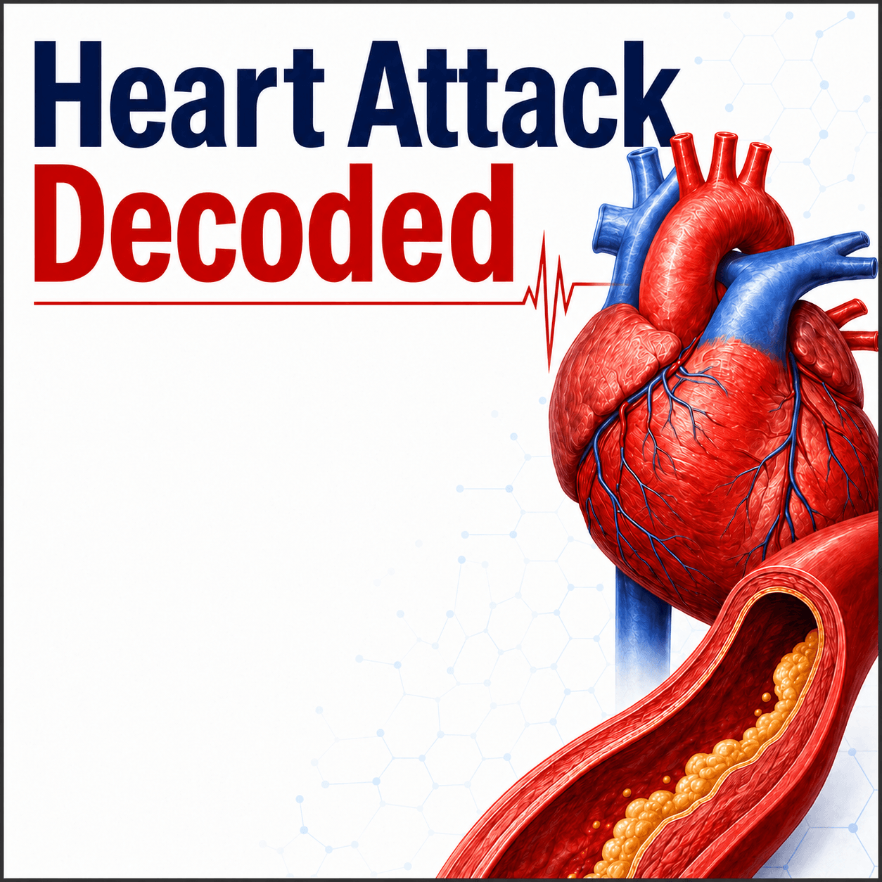 Heart Attack Decoded — cover